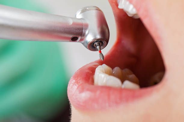 Best Orthodontic Emergency Dentist in Foothill Farms, CA